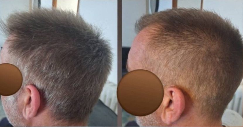 Coupe homme courte, avant et après